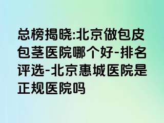 总榜揭晓:北京做包皮包茎医院哪个好-排名评选-北京惠城医院是正规医院吗